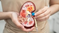 Penyebab Batu Ginjal yang Tak Diketahui, Bukan Cuma Kurang Minum