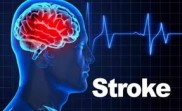 Stroke Bisa Menyerang Usia Muda, Ini Tanda yang Harus Dikenali